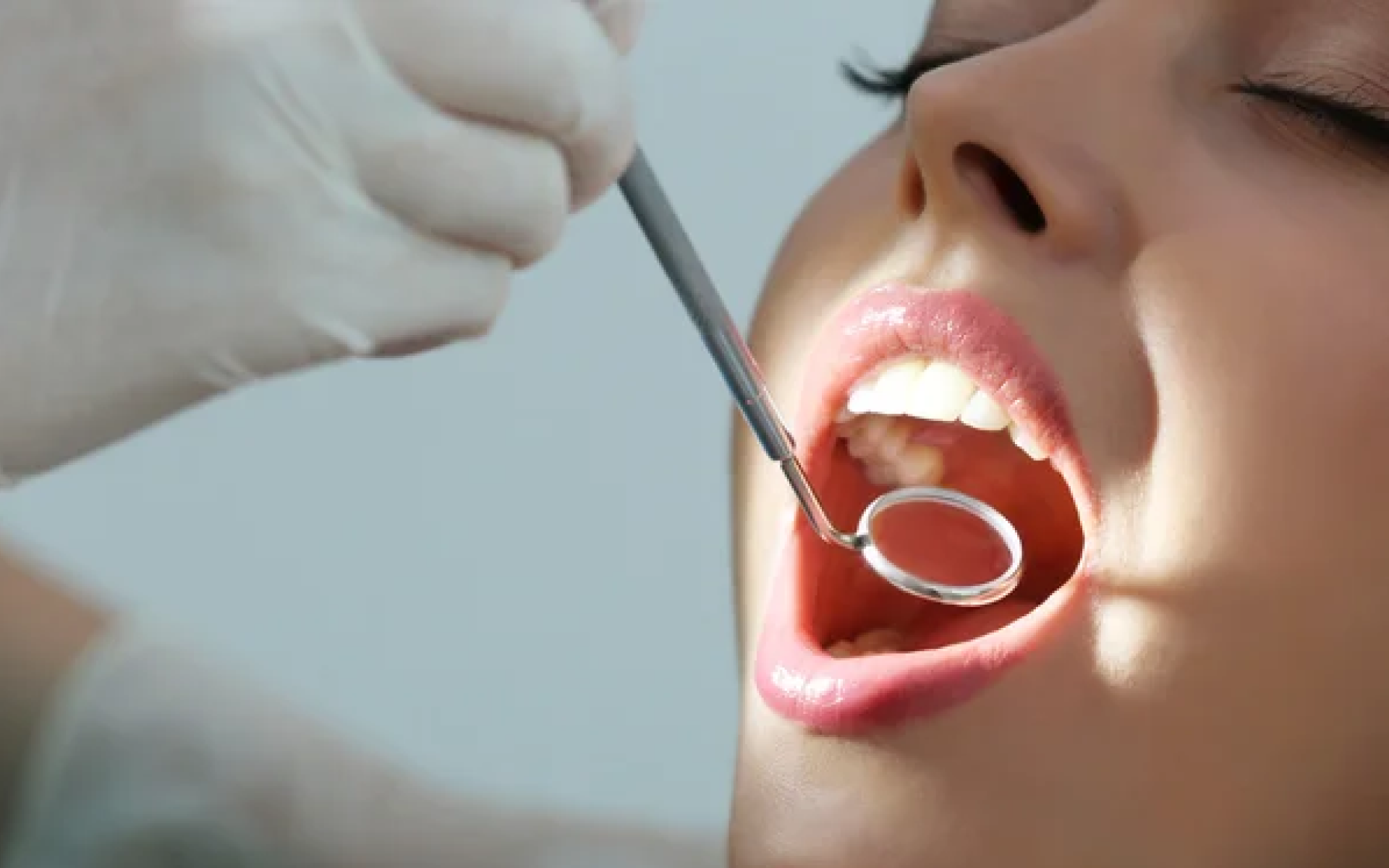 Clareamento dental: tudo o que você precisa saber antes de fazer