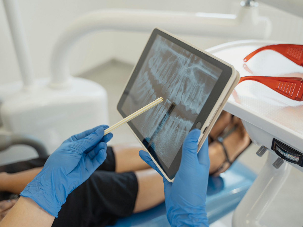 Implantes Dentários em Ubá: Descubra como recuperar seu sorriso e sua autoconfiança