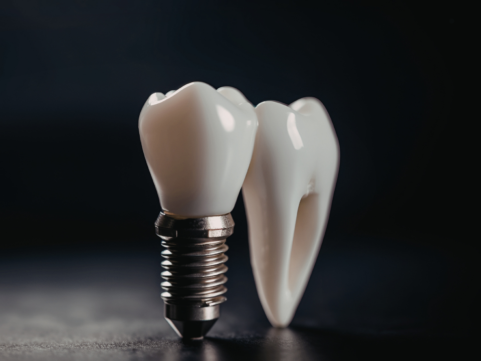 Chega de adesivos e insegurança: Vale a pena trocar a dentadura por uma prótese dentária fixa?