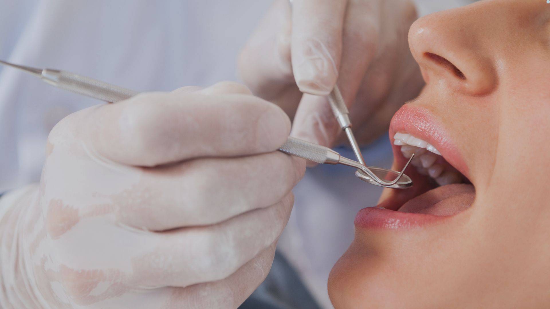 Quebrou o dente ou está com dor? Como resolver urgências odontológicas em Ubá com rapidez