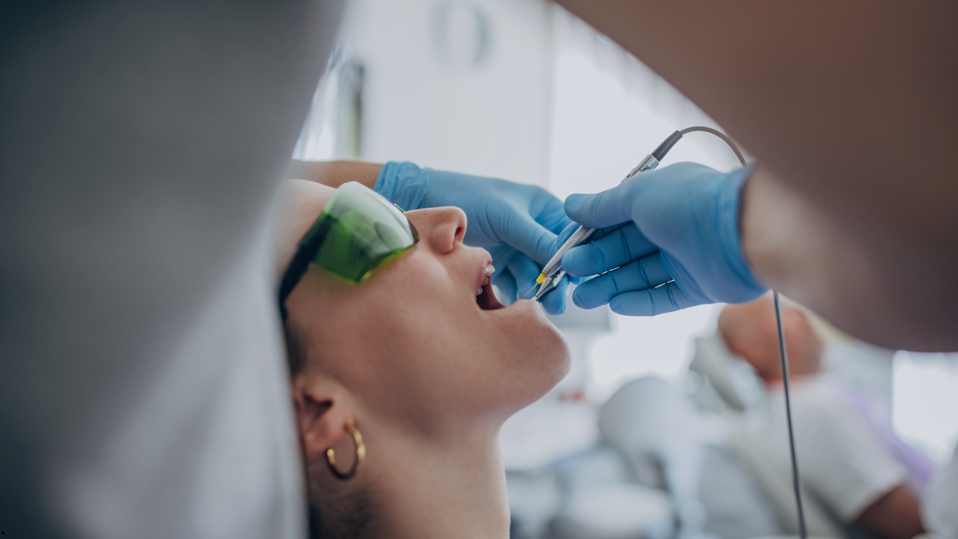 Implante Carga Imediata em Ubá: Como Funciona o Protocolo de Ter Dentes Fixos em Poucos Dias?